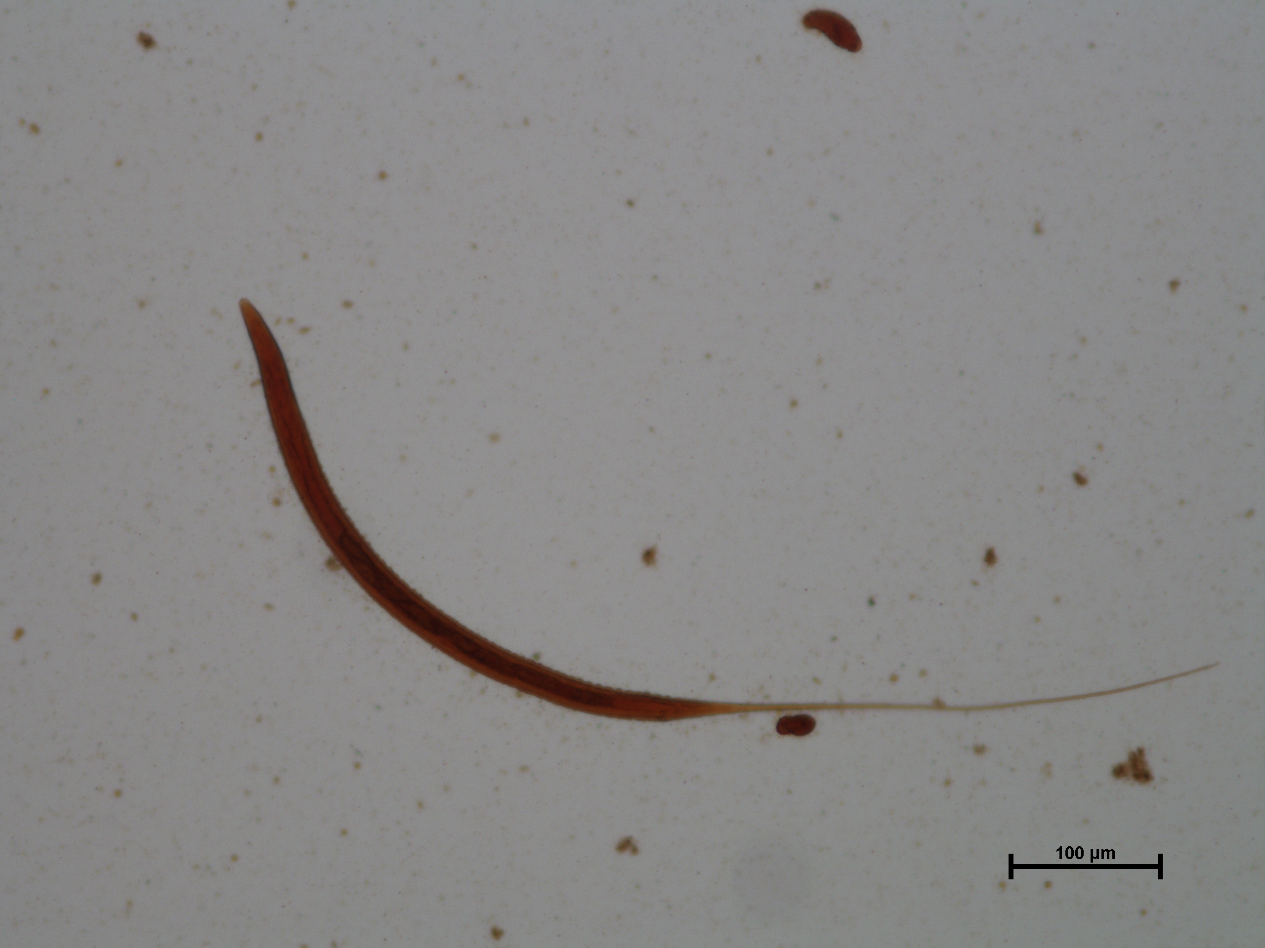 Larva tercer estadio de Gyalocephalus sp.